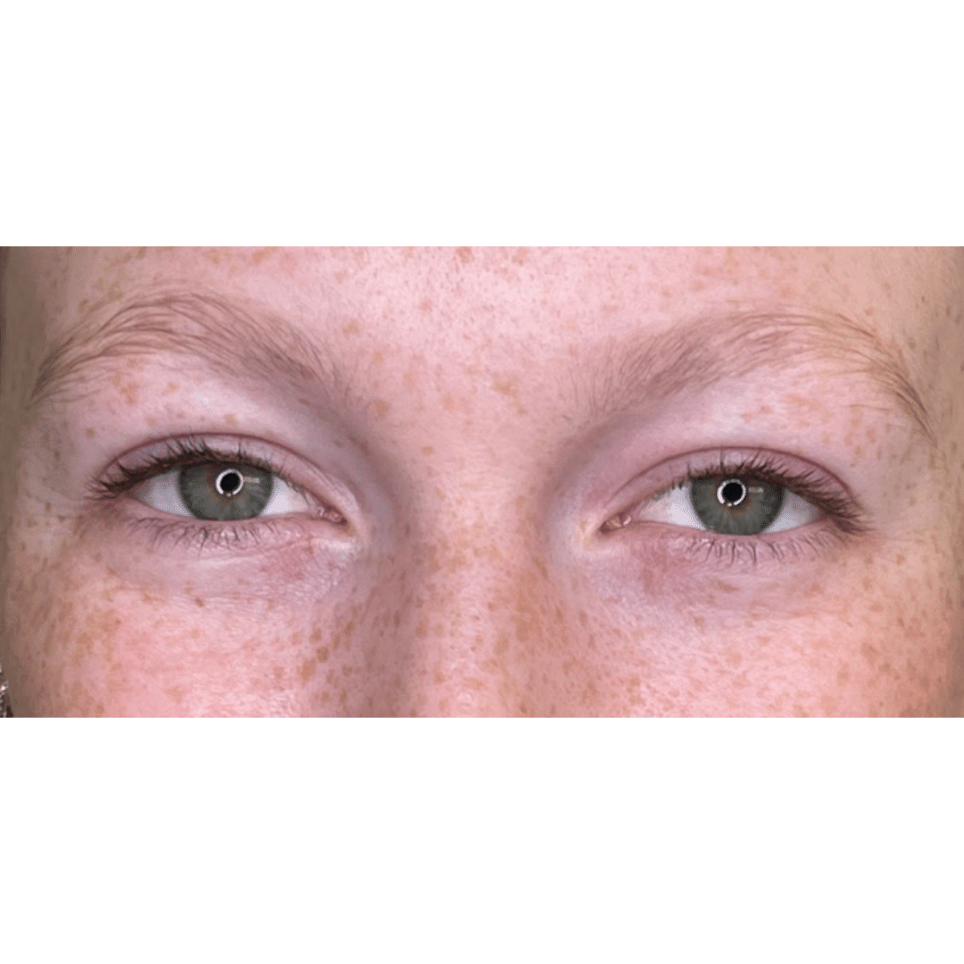 Brow Lamination and Tint Before