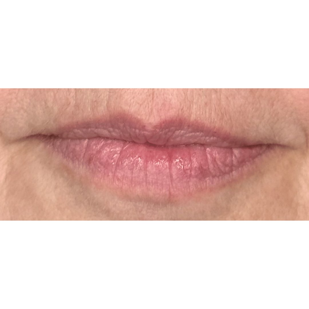 Lip Blush Before
